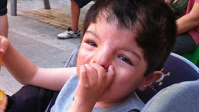 El caso de la niña valenciana con 16 malformaciones congénitas llega al TC