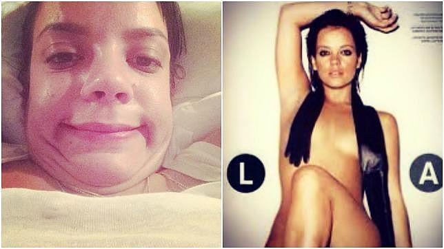 Lilly Allen muestra «su peor cara» en un «selfie» de Instagram