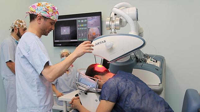 Los implantes de pelo se robotizan