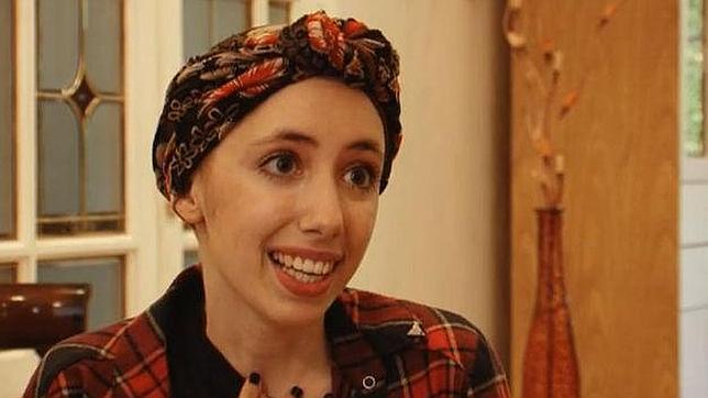 Una joven con cáncer escribe una emotiva carta: «Mi sonrisa sigue brillando»