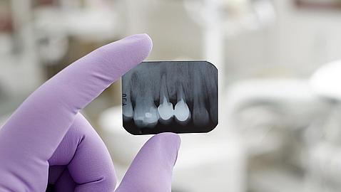 Implantes dentales, ¿son todos iguales?