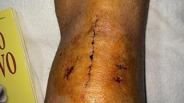 Así está la rodilla de Jesé