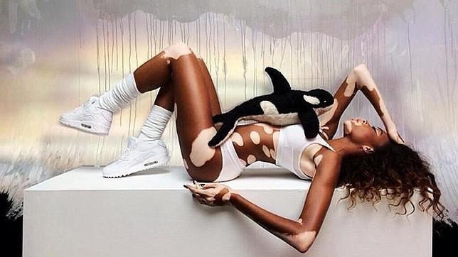 Winnie Harlow, primera modelo con vitíligo: «En el colegio me llamaban cebra»