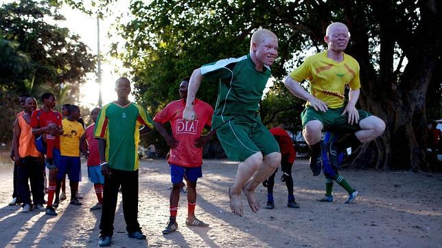 Arrestan a dos médicos por asesinar a una mujer albina en Tanzania