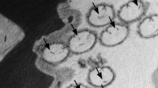 Descubren esperma gigante de gambas de 17 millones de años de antigüedad