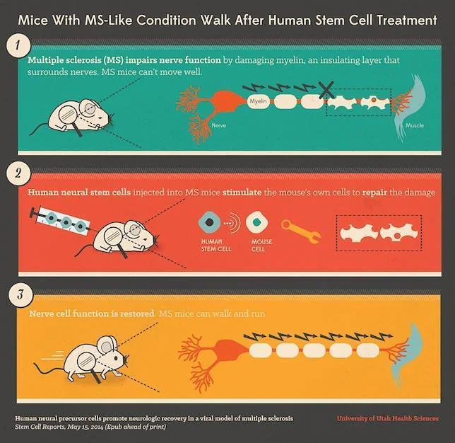 Una terapia celular logra que ratones con esclerosis múltiple puedan moverse