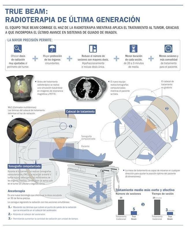 True beam: radioterapia más precisa cerca a los tumores