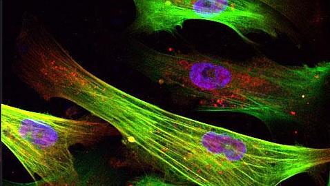 Células de la piel de pacientes inducidas a convertirse en células musculares lisas, algunas con anomalías, como un núcleo doble