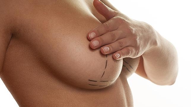 Muchas mastectomías dobles en mujeres con cáncer de mama son innecesarias
