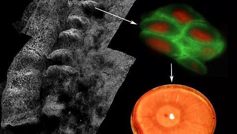Por vez primera regeneran en vivo un córnea humana con el uso de células madre adultas