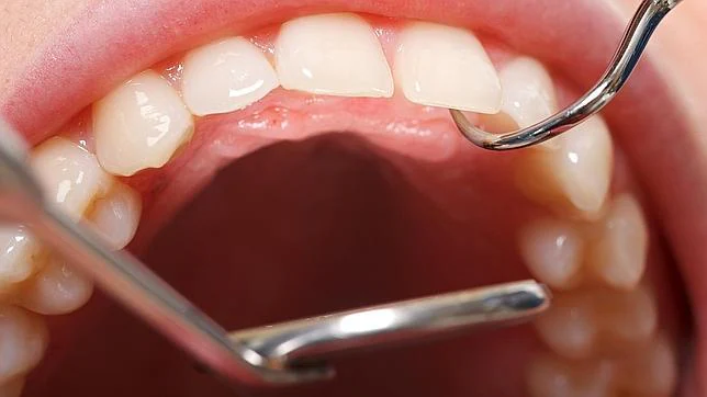 No tratar la periodontitis supone un mayor coste sanitario y más hospitalizaciones