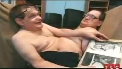 Ronnie y Donnie, (casi) 63 años viviendo unidos por el costado