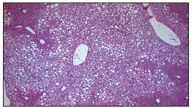 Una única inyección 'cura' la diabetes en ratones
