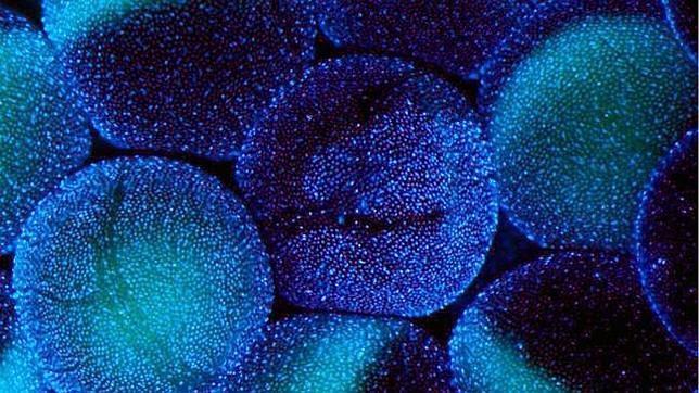 Demostrada la eficacia de un nuevo fármaco frente a células madre cancerígenas