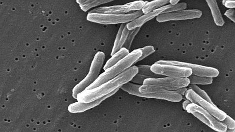 Puede que la abuela de Mycobacteium tuberculosis llegara a América «a bordo» de una foca
