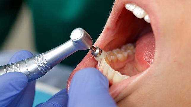 Que te saquen una muela puede costarte entre 22 y 250 euros, según la clínica dental