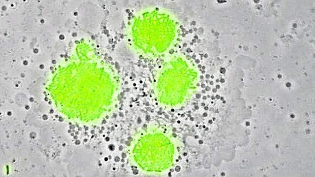 Diez cosas que debemos saber de la legionela