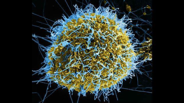 Partículas de virus ébola salen de una célula infectada