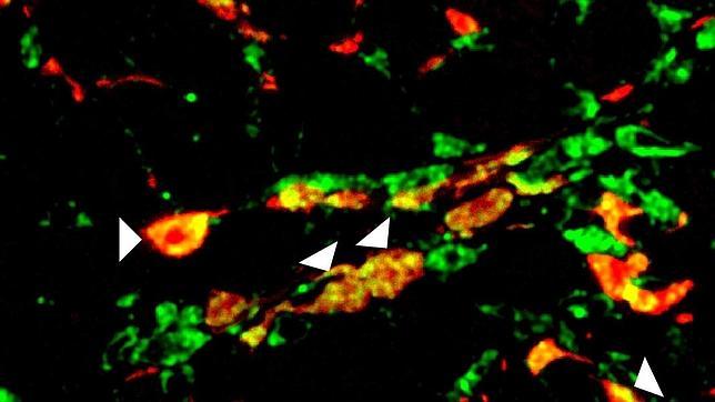 Algunas células implicadas en el daño tras un infarto también pueden curarlo