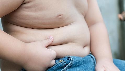 La obesidad reduce hasta en 8 años la expectativa de vida