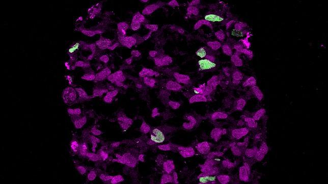 Fabrican por vez primera células humanas que se convierten en óvulos y espermatozoides