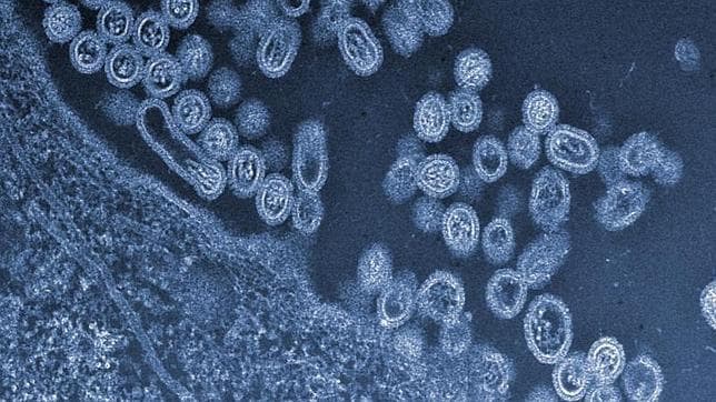 Imagen al microscopio del virus aviar H7N9