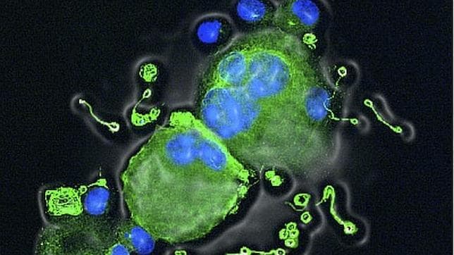 Dos megacariocitos deficientes en Cdk1 de los que emanan prolongaciones en las que se producen las plaquetas. El material genético se muestra en azul mientras que los cuerpos celulares aparecen en verde