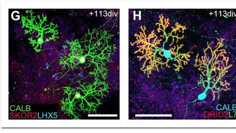 Desarrollan una estructura similar a un cerebelo con células iPS humanas