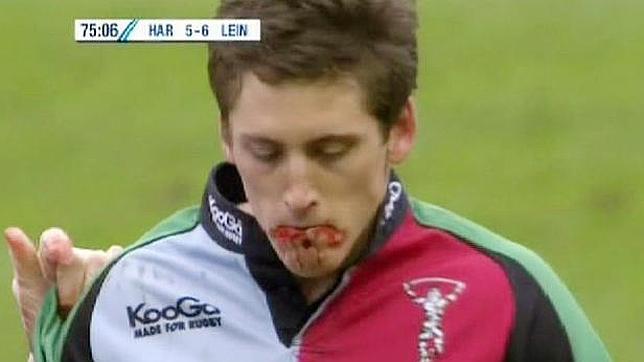 Tom Williams, con la boca falsamente ensangrentada