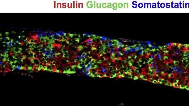 Trasplante de células madre y fármacos, el futuro para curar y tratar la diabetes