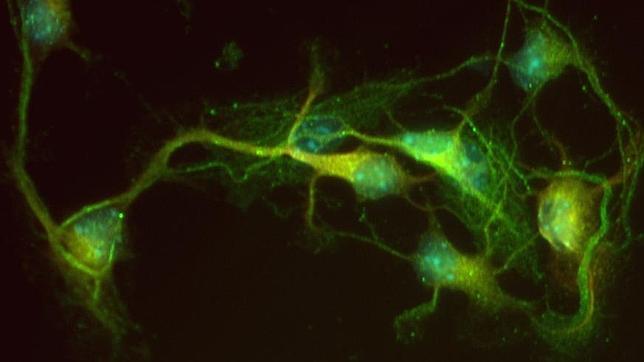 Investigadores españoles descubren nueva señalización en la transmisión de información entre las neuronas