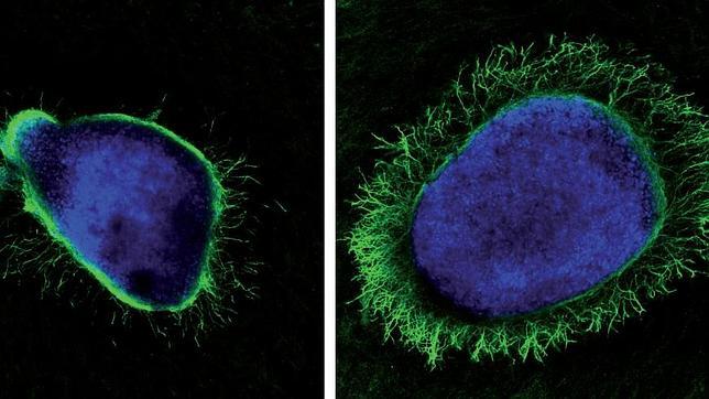 Una proteína generada por el virus del herpes potencia el crecimiento axonal