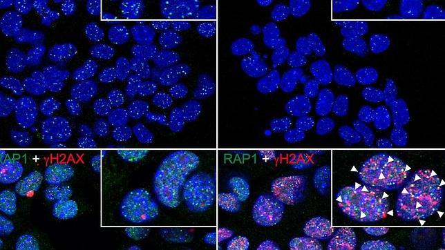 Científicos españoles descubren una forma de acabar con la inmortalidad del cáncer