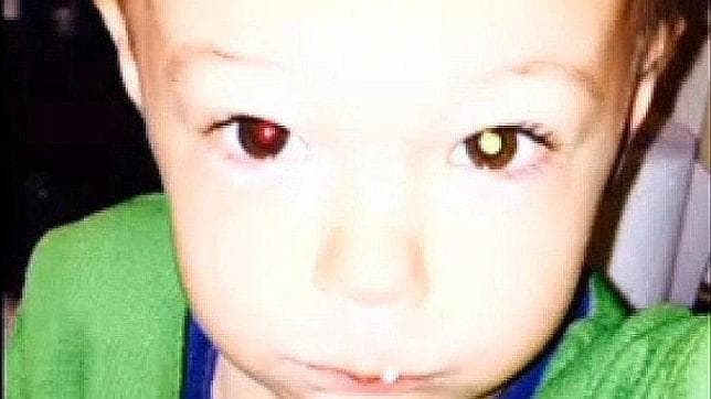 Cuando la pupila del pequeño no se volvió roja con el «flash», su madre se temió lo peor