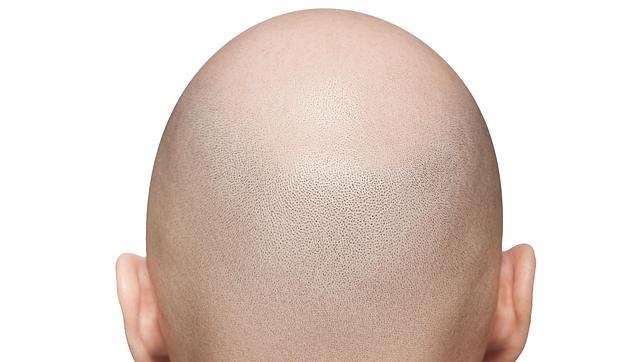 El cáncer de piel más agresivo, el melanoma, es más frecuente en los hombres que en las mujeres.