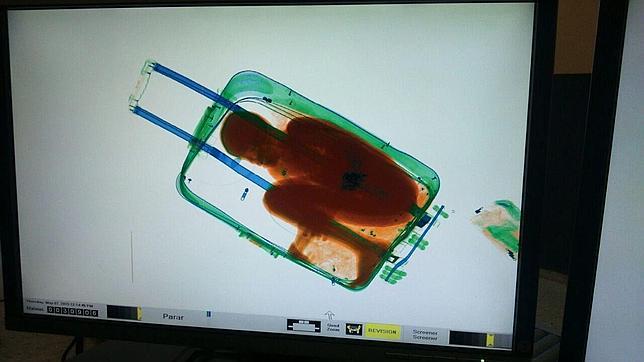 Imagen de Adou dentro de una maleta visto a través del escáner de la aduana