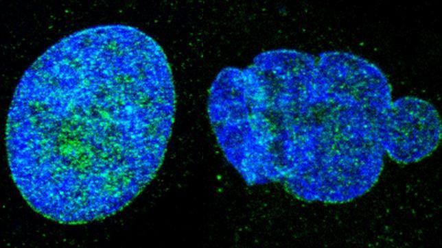 Logran reprogramar el envejecimiento en ratones y en células humanas