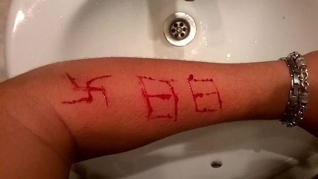 El brazo de la víctima después de la agresión