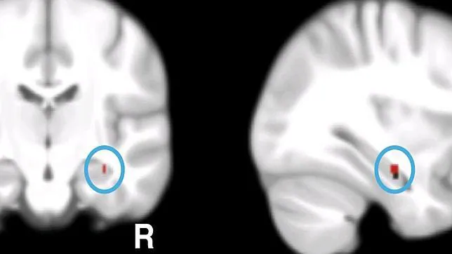 La imagen muestra el hipocampo del cerebro