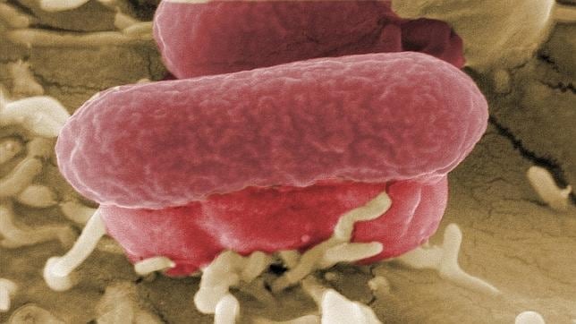 «Escherichia coli», al microscopio