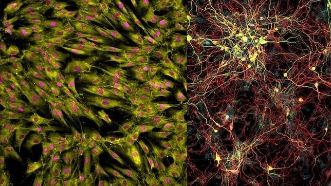Esta imagen muestra las diferencias entre las neuronas de las personas mayores y jóvenes cuando se convierten directamente a partir de células de la piel (izquierda) y las llamadas neuronas inducidas (derecha)
