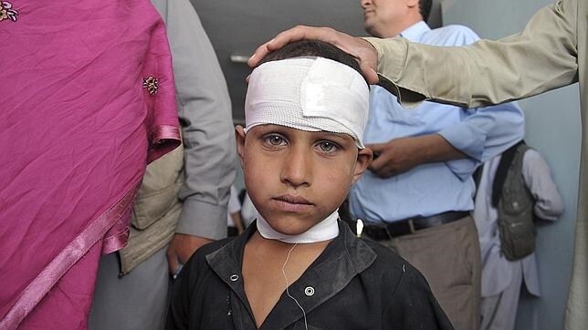 Instantánea de un niño afectado por el bombardeo