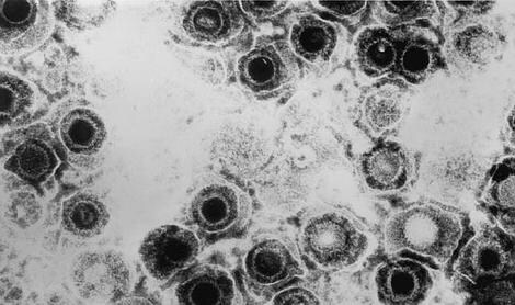 Aspecto del virus herpes simple, en el microscopio electrónico (CDC)