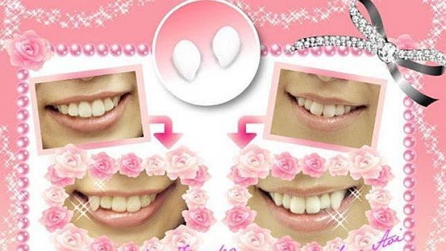 Dientes postizos para conseguir una dentadura perfecta