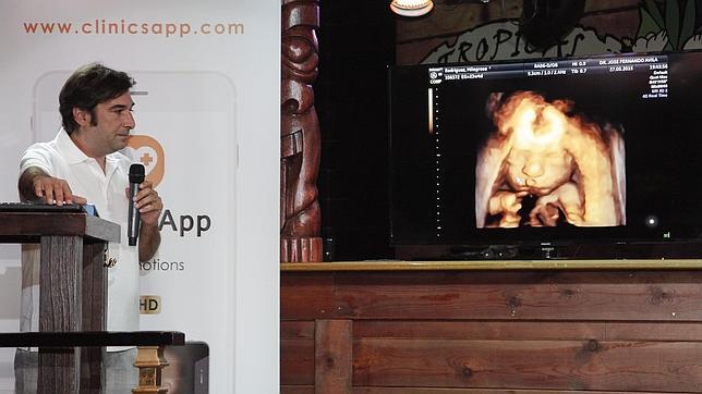 Presentan la primera app que permite a las embarazadas ver a su bebé en 3D y 4D