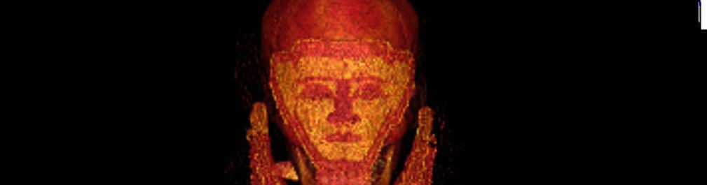 La mujer embalsamada descubierta por la Universidad de Jaén es la víctima de cáncer documentada