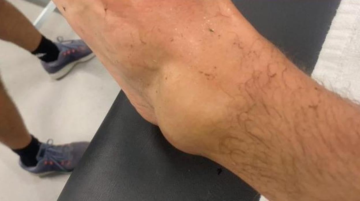 Imagen del tobillo de Canales