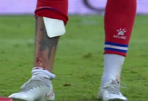 Corte en la pierna de Aleix Vidal tras la entrada de Pezzella