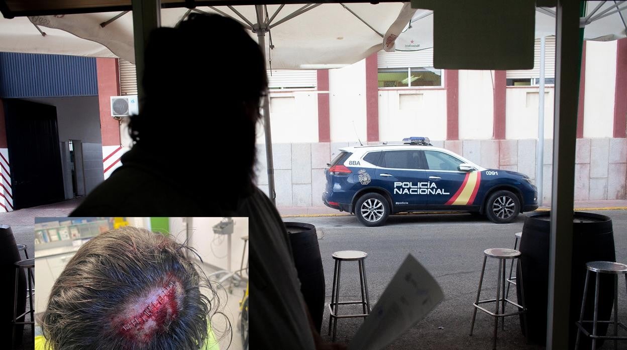 Imagen de los puntos de sutura y del camionero ya con la denuncia interpuesta