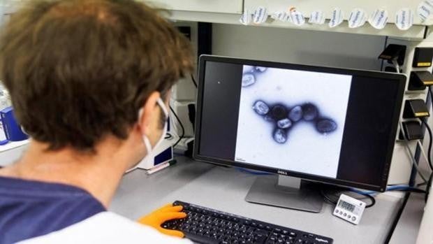 Andalucía supera los 50 casos de viruela del mono, la mayoría en Málaga